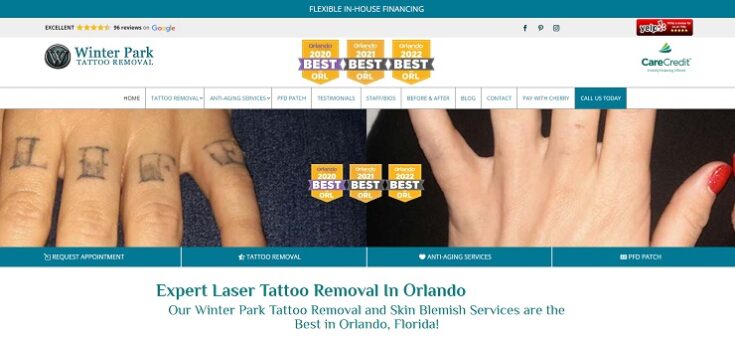 Winter Park Tattoo Removal